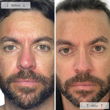 Load image into Gallery viewer, Omnilux Men's Mask