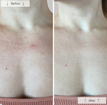 Load image into Gallery viewer, Omnilux Contour Neck & Décolleté