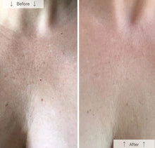 Load image into Gallery viewer, Omnilux Contour Neck & Décolleté