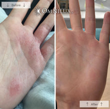 Load image into Gallery viewer, Omnilux Contour Glove