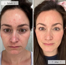 Load image into Gallery viewer, Omnilux Women&#39;s Contour Mask

