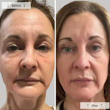 Load image into Gallery viewer, Omnilux Women&#39;s Contour Mask
