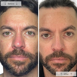 Omnilux Men's Mask