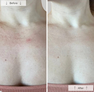 Omnilux Contour Neck & Décolleté