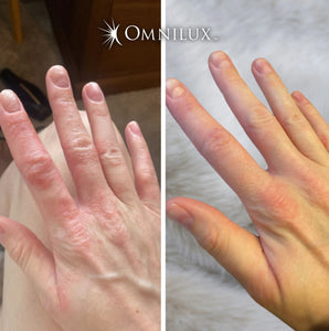 Omnilux Contour Glove