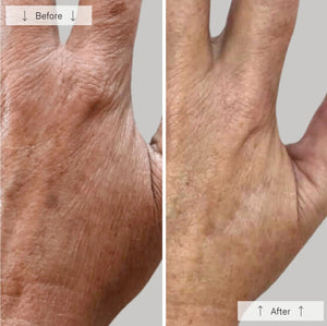 Omnilux Contour Glove
